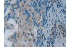 Detection of PLS3 in Mouse Stomach Tissue using Polyclonal Antibody to Plastin 3 (PLS3) (Plastin 3 anticorps  (AA 5-251))