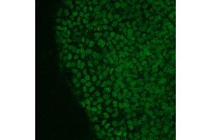 Immunofluorescence analysis of human iPS cells using NANOG antibody (green). (Nanog anticorps  (AA 20-166))
