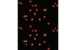 Immunofluorescence analysis of THP-1 cells using ENTPD1/CD39 Polyclonal Antibody (ABIN1679729, ABIN3018088, ABIN3018089 and ABIN6220354) at dilution of 1:100 (40x lens). (CD39 anticorps  (AA 1-180))