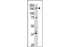 Image no. 1 for anti-ATP-Binding Cassette, Sub-Family B (MDR/TAP), Member 4 (ABCB4) (Center) antibody (ABIN358591)