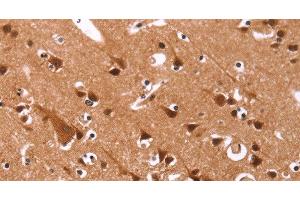 Immunohistochemistry of paraffin-embedded Human brain tissue using Cyclin D3 Polyclonal Antibody at dilution 1:40 (Cyclin D3 anticorps)