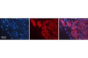 Rabbit Anti-WNT5A Antibody    Formalin Fixed Paraffin Embedded Tissue: Human Adult heart  Observed Staining: Cytoplasmic,Membrane Primary Antibody Concentration: 1:600 Secondary Antibody: Donkey anti-Rabbit-Cy2/3 Secondary Antibody Concentration: 1:200 Magnification: 20X Exposure Time: 0.