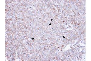 IHC-P Image Immunohistochemical analysis of paraffin-embedded DLD1 xenograft , using CAP1, antibody at 1:500 dilution.
