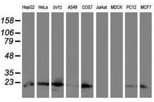 Image no. 2 for anti-Ubiquitin-Conjugating Enzyme E2E 3 (UBE2E3) antibody (ABIN1501628) (UBE2E3 anticorps)