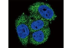 Confocal immunofluorescent analysis of Alkaline Phosphatase antibody with MCF-7 cells followed by Alexa Fluor 488-conjugated goat anti-rabbit lgG (green).