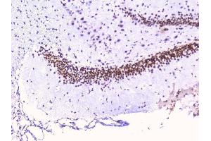 IHC analysis of RbAp48 using anti-RbAp48 antibody (ABIN5692929). (Retinoblastoma Binding Protein 4 anticorps  (C-Term))