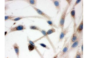 IHC analysis of TCP1 delta using anti-TCP1 delta antibody .
