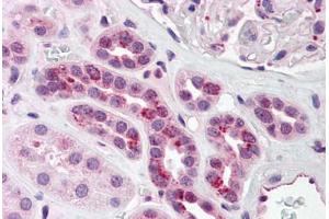 anti-Poly(rC) Binding Protein 4 (PCBP4) (C-Term) antibody