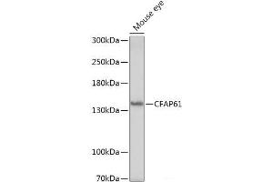 Western blot analysis of extracts of Mouse eye using CFAP61 Polyclonal Antibody at dilution of 1:1000. (CFAP61 anticorps)