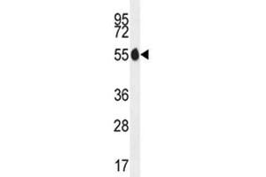 PAX1 antibody western blot analysis in MDA-MB435 lysate.