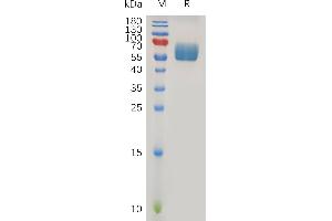 Human TG Protein, hFc Tag on SDS-PAGE under reducing condition.