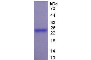 SDS-PAGE of Protein Standard from the Kit (Highly purified E. (PTF1A Kit ELISA)