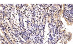 Detection of FAS in Porcine Small intestine Tissue using Polyclonal Antibody to Factor Related Apoptosis (FAS)