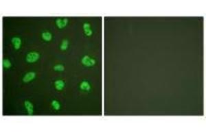 Immunofluorescence analysis of HeLa cells, treated with Forskolin (40nM, 30 mins), using DNA-PK antibody. (PRKDC anticorps)