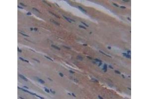 Used in DAB staining on fromalin fixed paraffin- embedded Kidney tissue