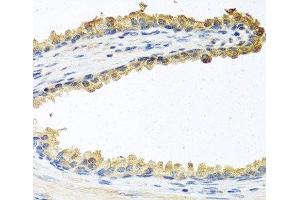 Immunohistochemistry of paraffin-embedded Human prostate using COCH Polyclonal Antibody at dilution of 1:100 (40x lens). (COCH anticorps)