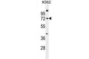 Western Blotting (WB) image for anti-Sphingomyelin phosphodiesterase 1, Acid Lysosomal (SMPD1) antibody (ABIN2996601) (SMPD1 anticorps)