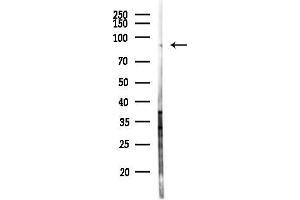 Western blot analysis of lysates from Hela cells(heat-shock 45 min treatment), using EVI5 Antibody at 1/1000 dilution.