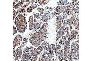 IHC analysis of MUT using anti-MUT antibody (ABIN4886676). (MUT anticorps  (N-Term))