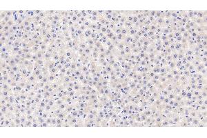 Detection of MT1 in Rat Liver Tissue using Polyclonal Antibody to Metallothionein 1 (MT1) (MT1 anticorps  (AA 1-61))