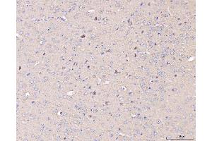 IHC analysis of MT-CO2 using anti-MT-CO2 antibody (ABIN7599081). (COX2 anticorps  (AA 1-205))