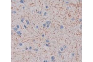 Used in DAB staining on fromalin fixed paraffin- embedded Kidney tissue (CDH23 anticorps  (AA 34-236))
