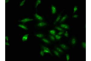 Immunofluorescence staining of Hela cells with ABIN7164337 at 1:100, counter-stained with DAPI. (DDX17 anticorps  (AA 591-692))