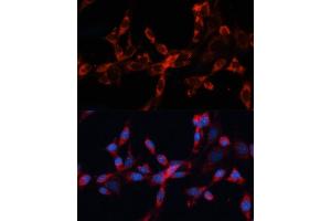 Immunofluorescence analysis of NIH/3T3 cells using Cathepsin L/V/K/H antibody (ABIN6127670, ABIN6139235, ABIN6139237 and ABIN6215636) at dilution of 1:100. (Cathepsin L anticorps  (AA 114-333))