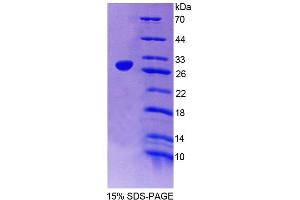 SDS-PAGE analysis of Mouse DKC Protein. (DKC1 Protéine)