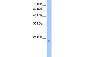 WB Suggested Anti-MGC4172 Antibody Titration:  0. (MGC4172 (C-Term) anticorps)