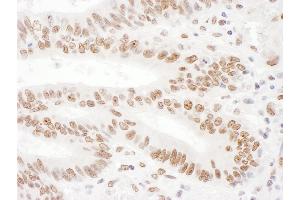Immunohistochemistry (IHC) image for anti-KH-Type Splicing Regulatory Protein (KHSRP) (AA 100-150) antibody (ABIN7454801)