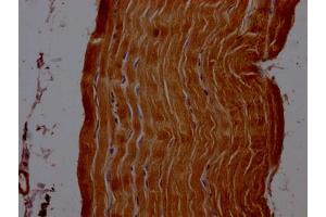 IHC image of ABIN7143815 diluted at 1:200 and staining in paraffin-embedded human skeletal muscle tissue performed on a Leica BondTM system.