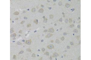 Immunohistochemistry of paraffin-embedded Rat brain using HSD17B13 Polyclonal Antibody at dilution of 1:100 (40x lens). (HSD17B13 anticorps)