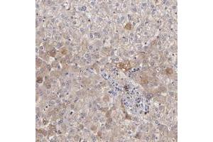Immunohistochemical staining of human liver with FGB polyclonal antibody  shows moderate cytoplasmic positivity in hepatocytes. (Fibrinogen beta Chain anticorps)