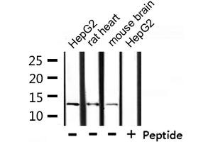 Western blot analysis of extracts from HepG2, rat heart and mouse brain, using NDUFA4L2 Antibody. (NDUFA4L2 anticorps  (C-Term))