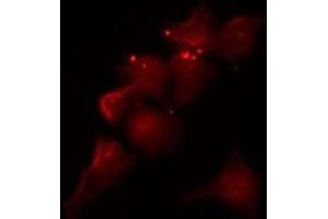 ABIN6275230 staining COLO205 by IF/ICC. (MGST2 anticorps  (Internal Region))