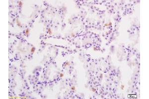 Formalin-fixed and paraffin embedded rat kidney tissue labeled with Anti-Phospho-YB1(Ser102) Polyclonal Antibody, Unconjugated (ABIN746918) at 1:200 followed by conjugation to the secondary antibody and DAB staining