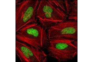 Confocal immunofluorescence analysis of Hela cells using CHK2 mouse mAb (green), showing nuclear localization. (CHEK2 anticorps  (AA 481-531))