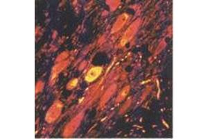 GABAergic neurons in the reticular nucleus of the thalamus (MAb 5A9, GABA)