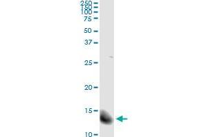 FABP4 (Human) IP-WB Antibody Pair
