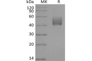 Western Blotting (WB) image for Transforming Growth Factor, beta Receptor 1 (TGFBR1) protein (Fc Tag) (ABIN7320892)
