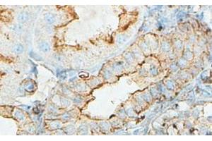 IHC analysis of formalin-fixed paraffin-embedded fetal kidney with cytoplasmic staining, using ACTBL2 antibody (1/100 dilution). (ACTBL2 anticorps  (Middle Region))