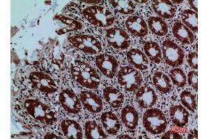 Immunohistochemistry (IHC) analysis of paraffin-embedded Human Colon, antibody was diluted at 1:100. (PROC anticorps  (Internal Region))