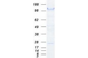 Validation with Western Blot