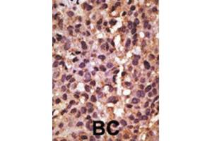 Immunohistochemistry (IHC) image for anti-BCL2/adenovirus E1B 19kDa Interacting Protein 3 (BNIP3) (BH3 Domain) antibody (ABIN2997216) (BNIP3 anticorps  (BH3 Domain))