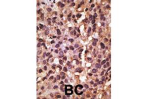 Immunohistochemistry (IHC) image for anti-BCL2/adenovirus E1B 19kDa Interacting Protein 3 (BNIP3) (BH3 Domain) antibody (ABIN2997216) (BNIP3 anticorps  (BH3 Domain))
