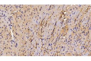 Detection of CAT in Mouse Cerebrum Tissue using Polyclonal Antibody to Catalase (CAT) (Catalase anticorps  (AA 401-523))