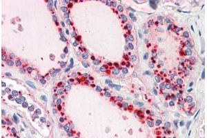 Human Thyroid: Formalin-Fixed, Paraffin-Embedded (FFPE)