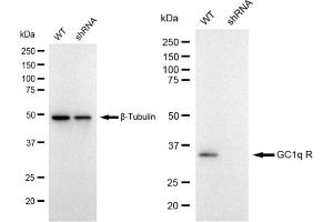 Western blotting analysis using GC1q R antibody (ABIN7798137). (Recombinant C1QBP anticorps)