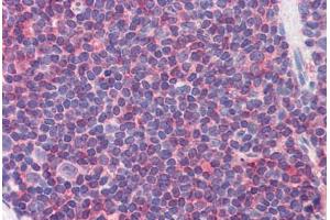 Human Colon, MALT (formalin-fixed, paraffin-embedded) stained with IL7R antibody ABIN351553 at 5 ug/ml followed by biotinylated goat anti-rabbit IgG secondary antibody ABIN481713, alkaline phosphatase-streptavidin and chromogen. (IL7R anticorps  (pTyr449))
